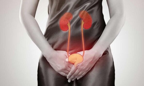 Causas y tratamiento de la cistitis en mujeres