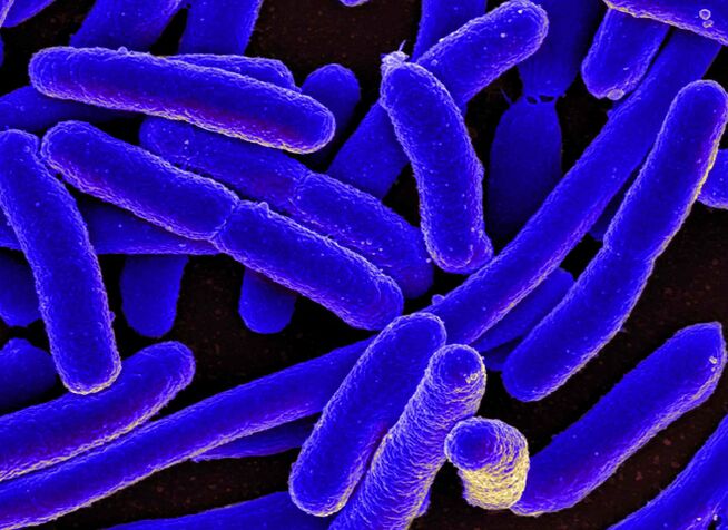 E. coli provoca con mayor frecuencia el desarrollo de cistitis en las mujeres